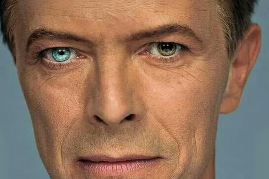 Yeux vairon